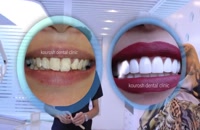 تجهیزات دندانپزشکی دندان 724