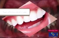 فیلم رهایی از سیاهی لثه دندان|کلینیک دندانپزشکی مدرن