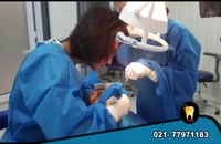 فیلم جراحی ایمپلنت دندان در کلینیک دندانپزشکی